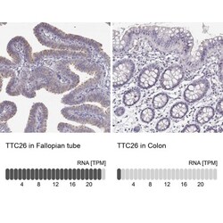 TTC26 Antibody, Novus Biologicals:Antibodies:Primary Antibodies